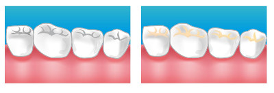 brosser les dents centre dentaire palaiseau